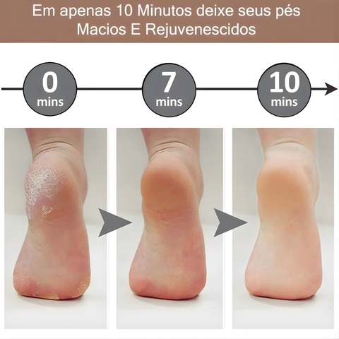 FOOTCLEAN - Lixa Elétrica Removedor de Calos e Rachaduras para os Pés