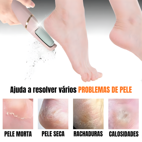 FOOTCLEAN - Lixa Elétrica Removedor de Calos e Rachaduras para os Pés