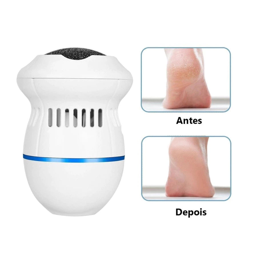 Removedor de calos e rachaduras Beauty Feet + 12 Lixas de Brinde
