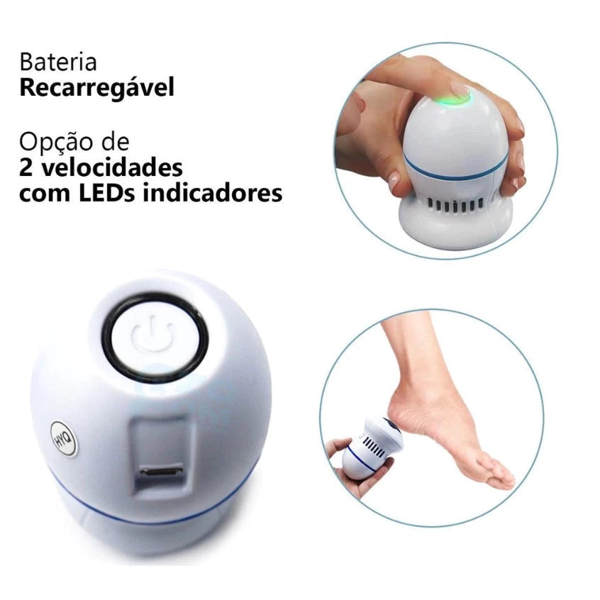 Removedor de calos e rachaduras Beauty Feet + 12 Lixas de Brinde
