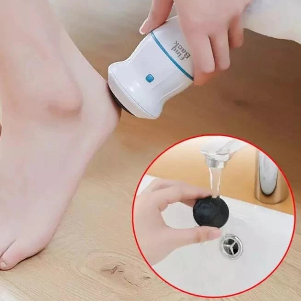 Removedor de calos e rachaduras Beauty Feet + 12 Lixas de Brinde